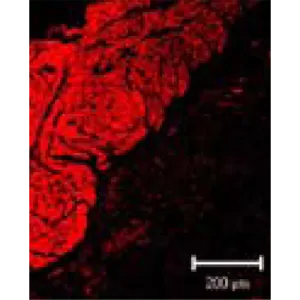 Anti-Smooth Muscle Actin - Mouse (B4)