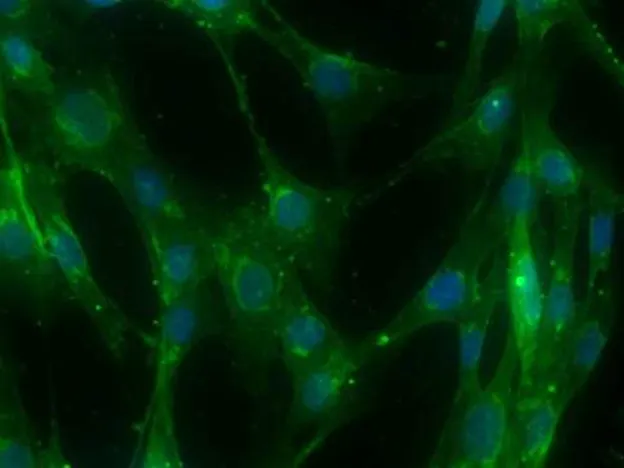 Primary Human Vascular Smooth Muscle Cells (Pooled) (CSC 2SM3)