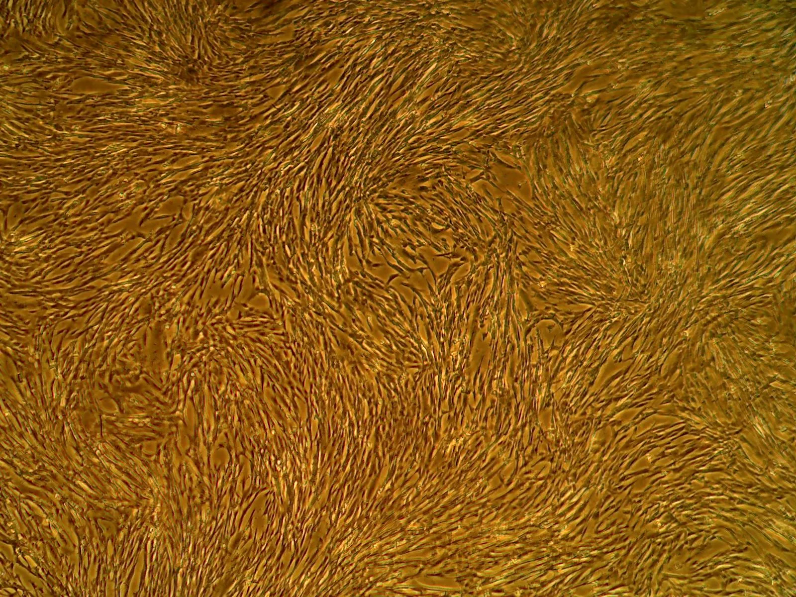Primary Human Vascular Smooth Muscle Cells (Pooled) (CSC 2SM3)